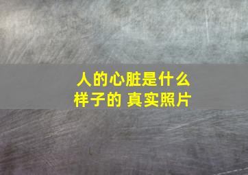 人的心脏是什么样子的 真实照片